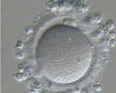 What is IVF?