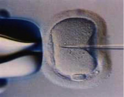 What is IVF?