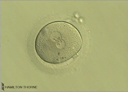 What is IVF?